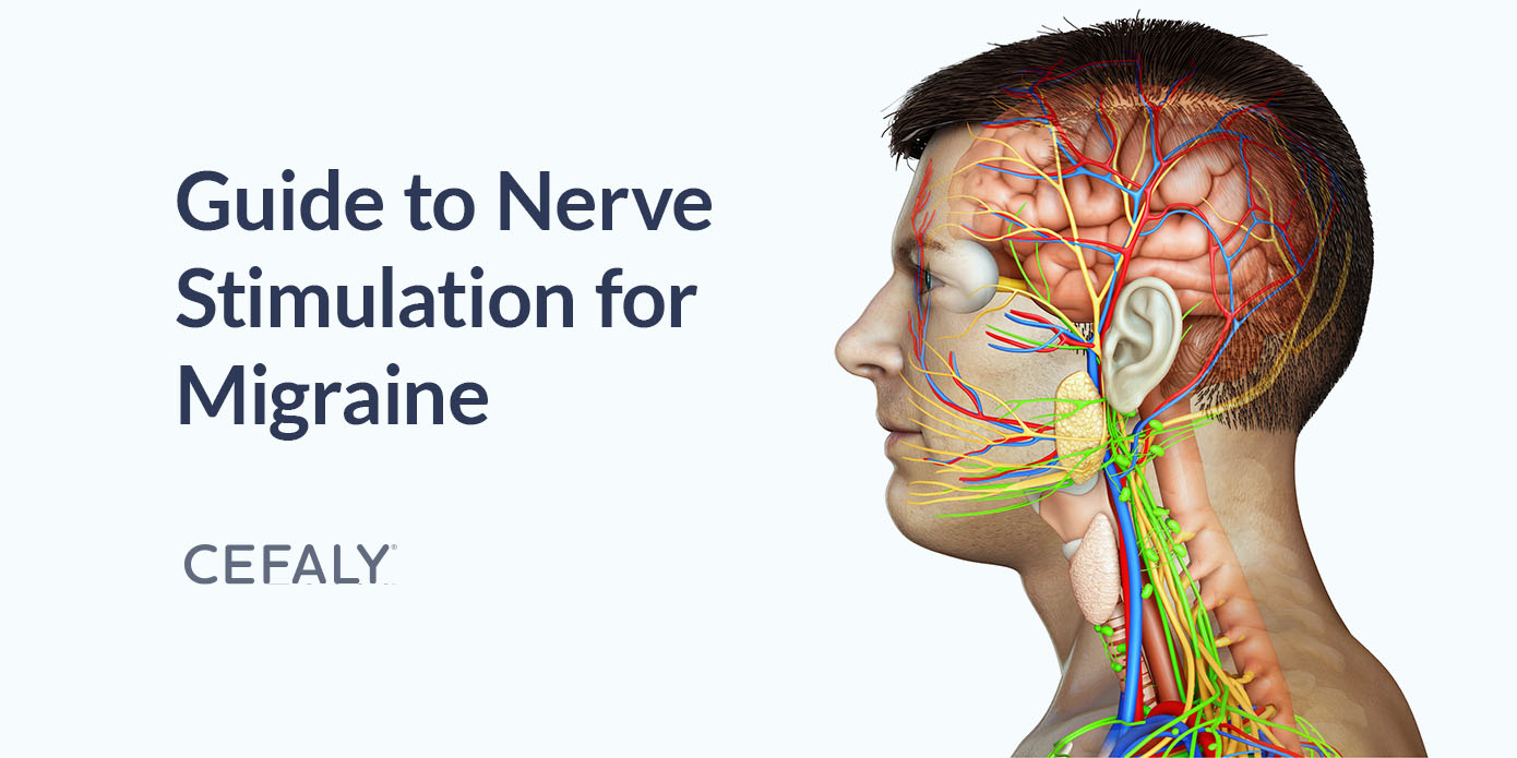 Guide to Nerve Stimulation for Migraine Guide to Nerve Stimulation for Migraine